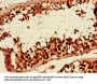 HLTF Antibody