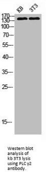 PLCG2 Antibody