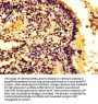 HMGB3 Antibody