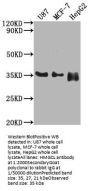 HMGCL Antibody