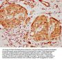 HMGCS1 Antibody