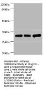 HNRNPA0 Antibody