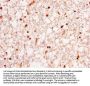 HNRNPA1 Antibody