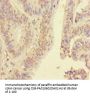HNRNPA2B1 Antibody