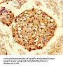 HNRNPA2B1 Antibody