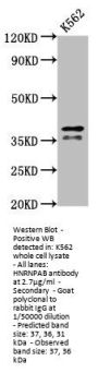 HNRNPAB Antibody