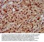 HNRNPAB Antibody