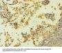 HNRNPH1 Antibody