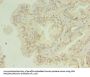 HNRNPL Antibody