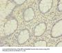 HNRNPL Antibody