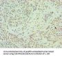 HNRNPM Antibody