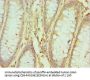 HNRNPM Antibody