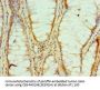 HNRNPM Antibody