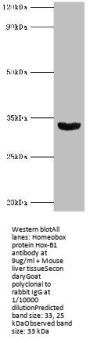 HOXB1 Antibody