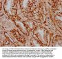 HOXB3 Antibody