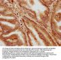 HOXD13 Antibody