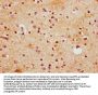 HOXD13 Antibody