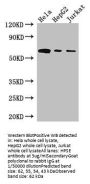 HPSE Antibody