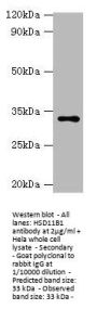 Rabbit anti-human Corticosteroid 11-beta-dehydrogenase isozyme 1 polyclonal Antibody