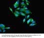 Rabbit anti-human Corticosteroid 11-beta-dehydrogenase isozyme 1 polyclonal Antibody