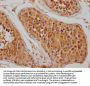HSPA1L Antibody
