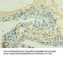 HSPA2 Antibody