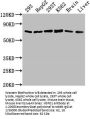HSPD1 Antibody