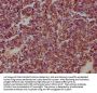 HSPD1 Antibody