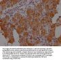 HTN3 Antibody