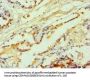 Rabbit anti-human 5-hydroxytryptamine receptor 2B polyclonal Antibody(PTGES3)