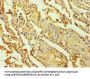Rabbit anti-human 5-hydroxytryptamine receptor 2B polyclonal Antibody(PTGES3)
