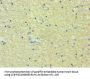 Rabbit anti-human 5-hydroxytryptamine receptor 2B polyclonal Antibody(PTGES3)
