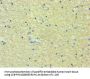 Rabbit anti-human 5-hydroxytryptamine receptor 2B polyclonal Antibody(PTGES3)