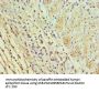 ICOSLG Antibody