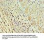 ICOSLG Antibody