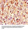 CHD4 Antibody