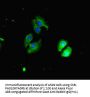 CHD4 Antibody