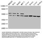 IDH1 Antibody