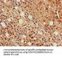 IDH1 Antibody