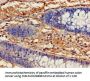 IDH1 Antibody