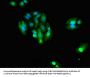IDH1 Antibody