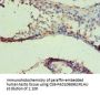 IDH1 Antibody