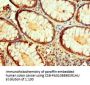 IDH1 Antibody