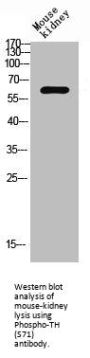 Phospho-TH (S71) Antibody