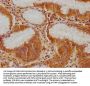 IFNA5 Antibody