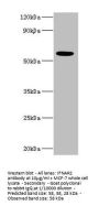 Rabbit anti-human Interferon alpha/beta receptor 2 polyclonal Antibody(IFNAR2)