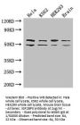IGF2BP3 Antibody