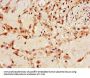 IGF2BP3 Antibody