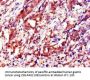 IGF2BP3 Antibody