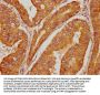 IGF2R Antibody